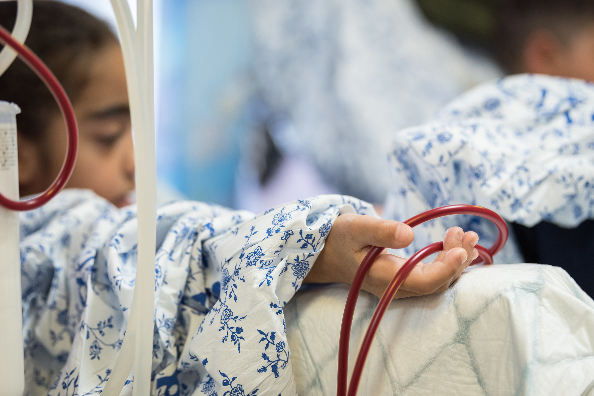 Ett barn eller en ungdom med suddat ansikte och slangar för blodtransfusion.