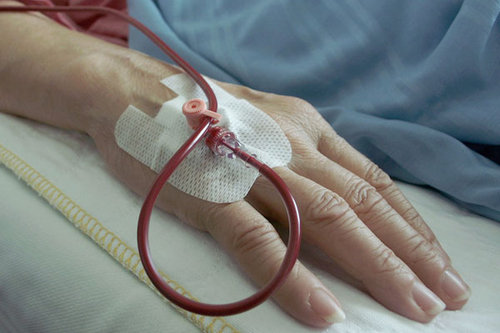En patients hand med dropp.